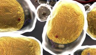 Findings suggest that normalization of blood fats may reduce risk of prostate cancer. Findings suggest that normalization of blood fats may reduce risk of prostate cancer.
