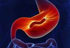 Gut Microbiota May Influence Endogenous Estrogen Metabolism Gut Microbiota May Influence Endogenous Estrogen Metabolism