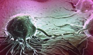 Experimental APC Platform Delivers Imaging, Radiotherapy Payloads Into Many Cancer Cells Experimental APC Platform Delivers Imaging, Radiotherapy Payloads Into Many Cancer Cells