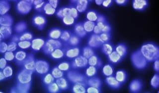 TP53 mutation, but not PIK3CA status, predicts treatment response in HER2-positive breast cancer. TP53 mutation, but not PIK3CA status, predicts treatment response in HER2-positive breast cancer.