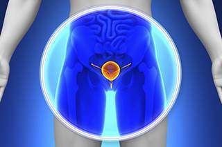 Further investigation between the circumcision and prostate cancer risk reduction is needed. Further investigation between the circumcision and prostate cancer risk reduction is needed.