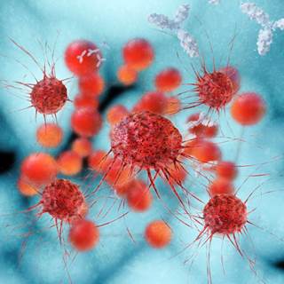 Patients with NF-1 are up to 4 times more likely to get both benign and malignant neoplasms. Patients with NF-1 are up to 4 times more likely to get both benign and malignant neoplasms.