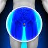 Review of CHAARTED Trial Results Review of CHAARTED Trial Results