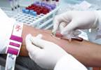 Copy Number Alterations Independently Associated with Prognosis for Acute Leukemia Copy Number Alterations Independently Associated with Prognosis for Acute Leukemia