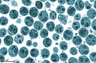 Pacritinib suppresses leukemic outgrowth from stroma-adherent cells in FLT3-ITD–driven AML. Pacritinib suppresses leukemic outgrowth from stroma-adherent cells in FLT3-ITD–driven AML.