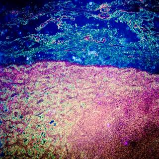 Rituximab should be used as maintenance therapy for the treatment of young previously untreated patients with mantle cell lymphoma. Rituximab should be used as maintenance therapy for the treatment of young previously untreated patients with mantle cell lymphoma.