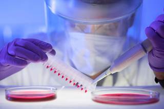 Outpatient autologous HSCT can result in excellent outcomes in multiple myeloma and lymphoma. Outpatient autologous HSCT can result in excellent outcomes in multiple myeloma and lymphoma.