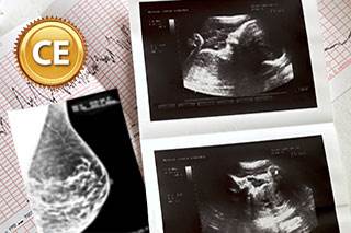 Breast cancer and pregnancy: Overlapping of two disciplines Breast cancer and pregnancy: Overlapping of two disciplines