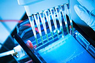 Gene expression signature analysis of HR+ breast tumors may predict survival. Gene expression signature analysis of HR+ breast tumors may predict survival.