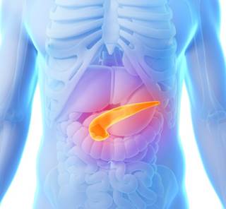 A study reported post-hoc subgroup analyses of the international phase 3 NAPOLI-1 trial. A study reported post-hoc subgroup analyses of the international phase 3 NAPOLI-1 trial.