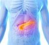 MM-398: A Potential New Option for Metastatic Pancreatic Cancer? MM-398: A Potential New Option for Metastatic Pancreatic Cancer?
