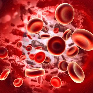 Patients with brain cancer are at increased risk of deep vein thrombosis and consequently pulmonary Patients with brain cancer are at increased risk of deep vein thrombosis and consequently pulmonary