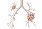 Pembrolizumab Significantly Prolongs OS Compared With Chemotherapy in NSCLC Pembrolizumab Significantly Prolongs OS Compared With Chemotherapy in NSCLC