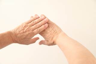 Onset of sorafenib-associated hand–foot skin reactions can be delayed by urea-based cream plus best supportive care. Onset of sorafenib-associated hand–foot skin reactions can be delayed by urea-based cream plus best supportive care.