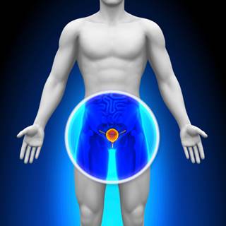 Some researchers are looking at the evidence and urging for a middle ground in prostate cancer screening guidelines Some researchers are looking at the evidence and urging for a middle ground in prostate cancer screening guidelines