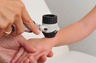 A novel risk score may be able to identify patients who are at risk for developing melanoma. A novel risk score may be able to identify patients who are at risk for developing melanoma.