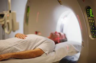 Donepezil slightly improves several cognitive functions in brain tumor survivors who have undergone irradiation. Donepezil slightly improves several cognitive functions in brain tumor survivors who have undergone irradiation.