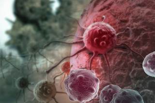 The first clinical trial of an anti-B-cell maturation antigen chimeric antigen receptor (CAR-BCMA) has shown strong anti-myeloma activity. The first clinical trial of an anti-B-cell maturation antigen chimeric antigen receptor (CAR-BCMA) has shown strong anti-myeloma activity.