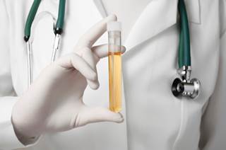 Research indicates that a test of AQP1 and PLIN2 levels in urine may act as an indicator of early stage RCC. Research indicates that a test of AQP1 and PLIN2 levels in urine may act as an indicator of early stage RCC.