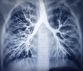 Erlotinib treatment beyond disease progression in Asian patients with EGFR-positive NSCLC is feasible and may delay salvage therapy in some patients. Erlotinib treatment beyond disease progression in Asian patients with EGFR-positive NSCLC is feasible and may delay salvage therapy in some patients.