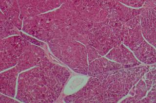 New, less aggressive guidelines have been developed for management of pancreatic cysts. New, less aggressive guidelines have been developed for management of pancreatic cysts.