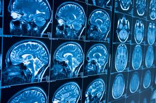 Chemotherapy and multimodality treatment seemed to improve survival probabilities in men with bone metastases from germ cell tumors. Chemotherapy and multimodality treatment seemed to improve survival probabilities in men with bone metastases from germ cell tumors.