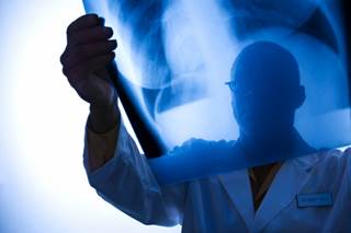 TNFi treatment is not associated with increased risk for cancer recurrence in patients with RA. TNFi treatment is not associated with increased risk for cancer recurrence in patients with RA.