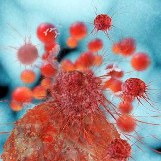 Researchers have identified novel recurrently mutated genes and pathways in follicular lymphoma. Researchers have identified novel recurrently mutated genes and pathways in follicular lymphoma.