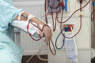 Induction therapy with bortezomib and high cut-off hemodialysis may be an effective treatment in multiple myeloma with renal insufficiency. Induction therapy with bortezomib and high cut-off hemodialysis may be an effective treatment in multiple myeloma with renal insufficiency.