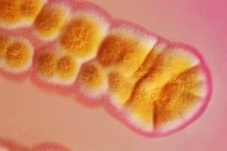 Astellas has announced the launch of Cresemba (isavuconazonium sulfate) for invasive aspergillosis, mucormycosis. Astellas has announced the launch of Cresemba (isavuconazonium sulfate) for invasive aspergillosis, mucormycosis.