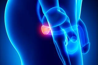 A significant reduction in prostate cancer–specific mortality — the primary outcome — was observed among patients who received 18 months of AS. A significant reduction in prostate cancer–specific mortality — the primary outcome — was observed among patients who received 18 months of AS.