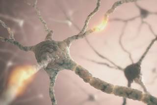 CNS relapse in peripheral T-cell lymphoma occurs at a frequency similar to B-cell lymphomas. CNS relapse in peripheral T-cell lymphoma occurs at a frequency similar to B-cell lymphomas.