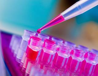 Patients with chronic lymphocytic leukemia (CLL) treated with ibrutinib may have a mildly elevated risk of developing Pneumocystis jirovecii pneumonia. Patients with chronic lymphocytic leukemia (CLL) treated with ibrutinib may have a mildly elevated risk of developing Pneumocystis jirovecii pneumonia.