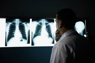 Less frequent dosing with zoledronic acid does not increase fracture risk in patients with bone metastases. Less frequent dosing with zoledronic acid does not increase fracture risk in patients with bone metastases.