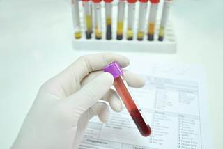 Complete response rate at 30 months is a surrogate endpoint for progression-free survival in first-line follicular lymphoma trials. Complete response rate at 30 months is a surrogate endpoint for progression-free survival in first-line follicular lymphoma trials.