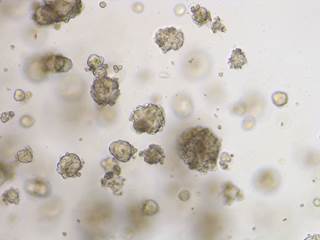 Tumor organoids (Photo courtesy of Marc van de Wetering, Hubrecht Institute) Tumor organoids (Photo courtesy of Marc van de Wetering, Hubrecht Institute)