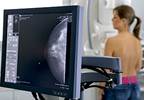 Breast Cancer Risk Varied With Thyroid Function Level Breast Cancer Risk Varied With Thyroid Function Level
