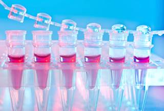 Biggest predictors of survival following hematopoietic transplantation are donor age and donor-recipient human leukocyte antigen-match. Biggest predictors of survival following hematopoietic transplantation are donor age and donor-recipient human leukocyte antigen-match.