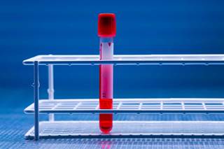 KPT-8602 allows a prolonged frequent dosing schedule in animal models of chronic lymphocytic leukemia (CLL) and acute myeloid leukemia. KPT-8602 allows a prolonged frequent dosing schedule in animal models of chronic lymphocytic leukemia (CLL) and acute myeloid leukemia.