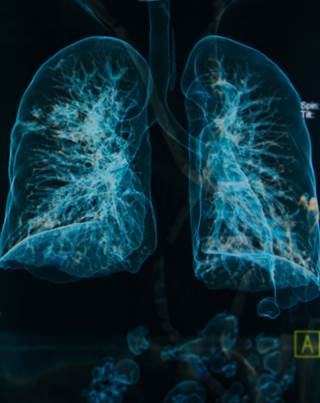 Patients with single organ metastatic stage 4 non-small cell lung cancer, especially those with low TN status, have favorable prognosis. Patients with single organ metastatic stage 4 non-small cell lung cancer, especially those with low TN status, have favorable prognosis.