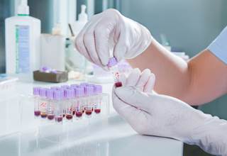 Ofatumumab monotherapy was active and well tolerated among patients with previously untreated or relapsed Waldenström macroglobulinemia. Ofatumumab monotherapy was active and well tolerated among patients with previously untreated or relapsed Waldenström macroglobulinemia.