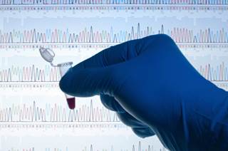 The proliferation of cancer-risk gene panels meant to clarify a person’s risks can often create confusion instead. The proliferation of cancer-risk gene panels meant to clarify a person’s risks can often create confusion instead.