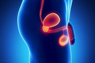 The U.S. Food and Drug Administration has approved 2 types of minimally invasive, high intensity focused ultrasound therapy for treating prostate cancer. The U.S. Food and Drug Administration has approved 2 types of minimally invasive, high intensity focused ultrasound therapy for treating prostate cancer.