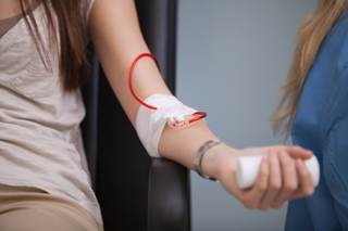 A protein-based blood test can detect the presence of breast cancer, and may help lower the number of benign breast biopsies performed. A protein-based blood test can detect the presence of breast cancer, and may help lower the number of benign breast biopsies performed.