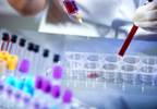Ambient Benzene Exposure and Risk of Hematologic Malignancies Ambient Benzene Exposure and Risk of Hematologic Malignancies