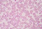 Ponatinib Induces Durable Responses in Patients With CML for at Least 4 Years Ponatinib Induces Durable Responses in Patients With CML for at Least 4 Years