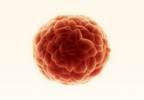 Senescent Effects on Cancer Cells Are Context-dependent Senescent Effects on Cancer Cells Are Context-dependent