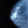 Managing Menopausal Symptoms in Breast Cancer Survivors Managing Menopausal Symptoms in Breast Cancer Survivors