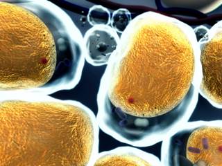 Combination therapy showed activity in epidermal growth factor receptor-mutated, mesenchymal-epithelial transition factor-dysregulated non–small-cell lung cancer. Combination therapy showed activity in epidermal growth factor receptor-mutated, mesenchymal-epithelial transition factor-dysregulated non–small-cell lung cancer.