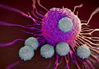 Delayed mRCC Targeted Therapy Does Not Worsen Survival Delayed mRCC Targeted Therapy Does Not Worsen Survival